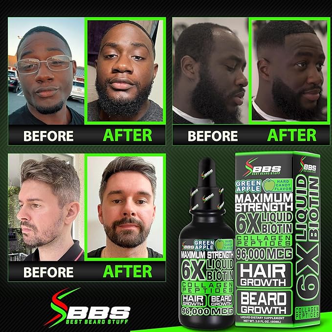 MAXIMUM STRENGTH Biotin 96,000mcg Collagen Peptides LIQUID Collagen for Men Hair Growth & Beard Growth Supplement with 6X More Absorption vs Competitor Vitamins, Serum, or Pills (2 OZ) made by BBS USA