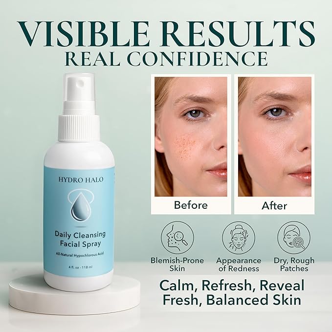 0.02% Hypochlorous Acid Spray for Face & Skin 4oz – Hydrating Facial Mist, Calm & Soothe Irritation, Post-Workout, pH Balanced, No Alcohol, Daily Skin Care, Made in USA